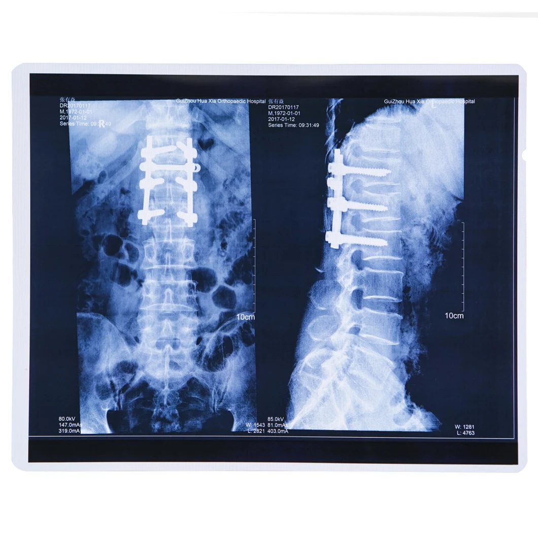 FUJI Printer Using Laser Medical X-ray Film 35X43 Cm